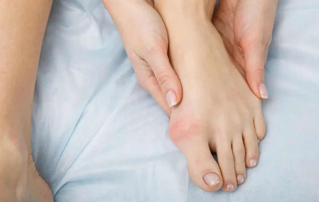 βλαισός μέγας δάκτυλος